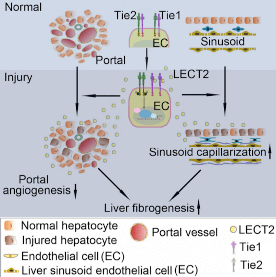 CELL|科研团队揭示肝纤维化与血管新生新机制