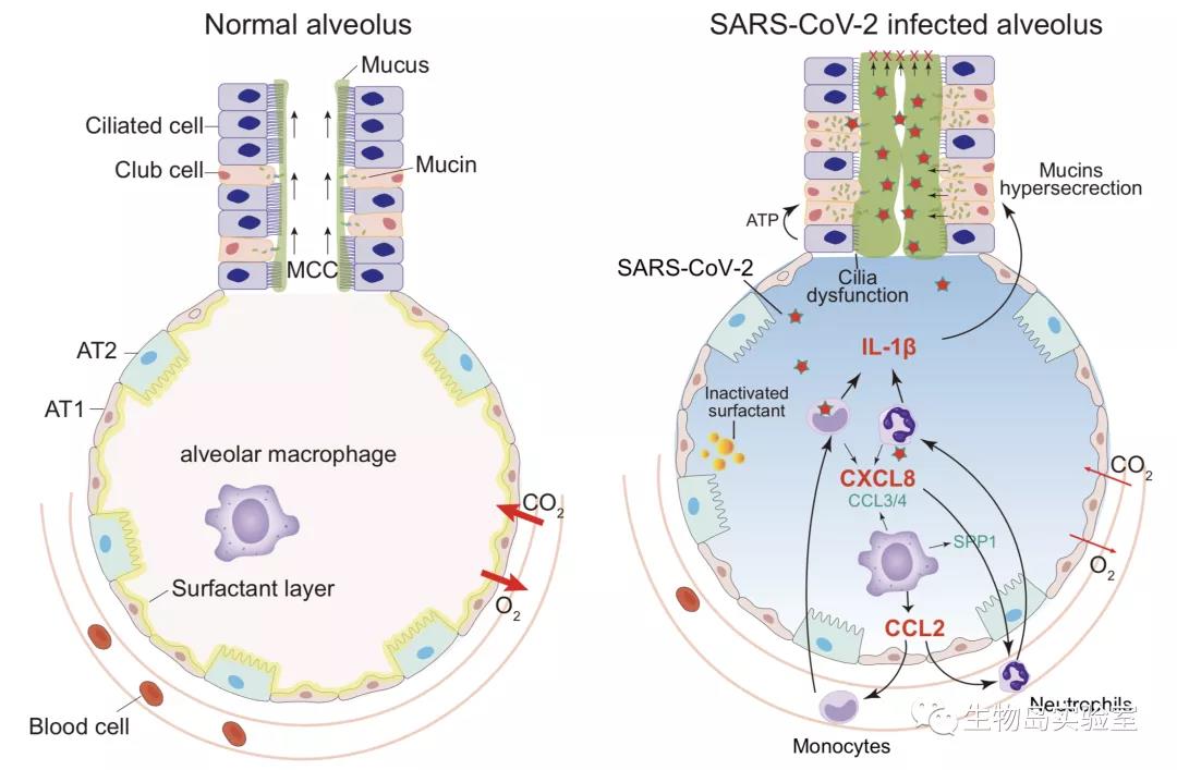 Protein & Cell | 生物岛实验室合作揭示新冠病毒感染导致急性呼吸窘迫症的细胞机理